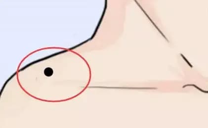 nốt ruồi, tướng số, tướng mạo