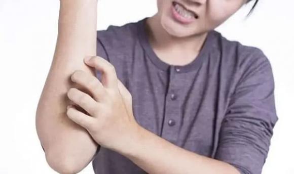 mụn thịt, chăm sóc sức khỏe, da có mụn thịt