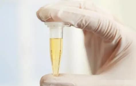 bệnh thận, đi tiểu, bệnh thận