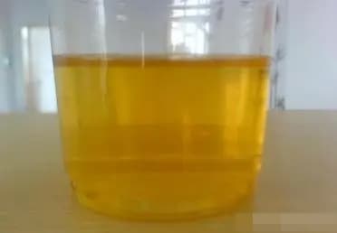 bệnh thận, đi tiểu, bệnh thận