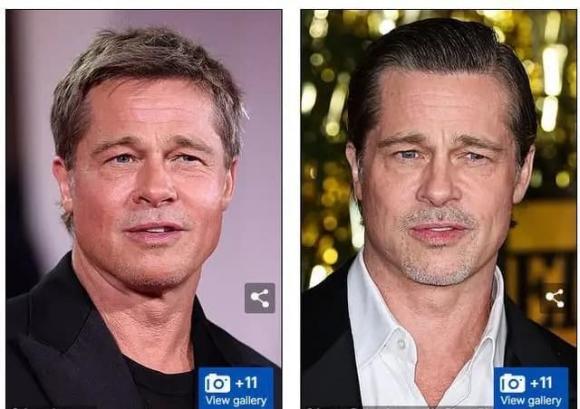 Brad Pitt, phẫu thuật thẩm mỹ, angelina jolie