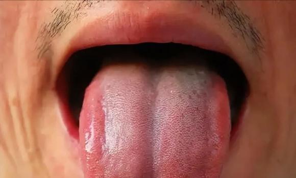 vàng da, vàng mắt, nước tiểu vàng, sức khỏe, người có 3 vàng thường không sống lâu, Người có 3 màu vàng thì tuổi thọ không được dài