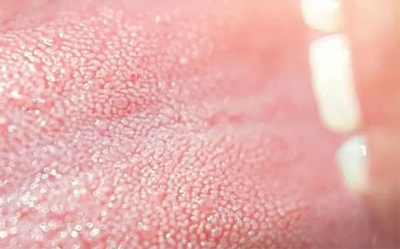 lưỡi, chăm sóc sức khỏe, bệnh tật