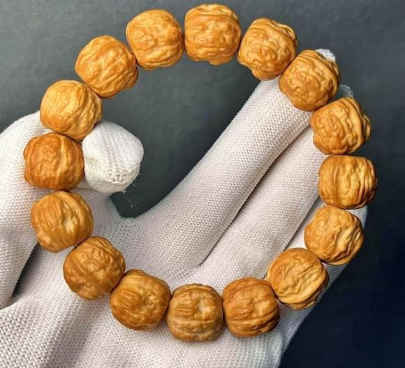 3 loại trang sức tiềm ẩn nguy cơ gây ung thư
