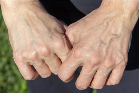 tuổi thọ, mu bàn tay liên quan đến tuổi thọ