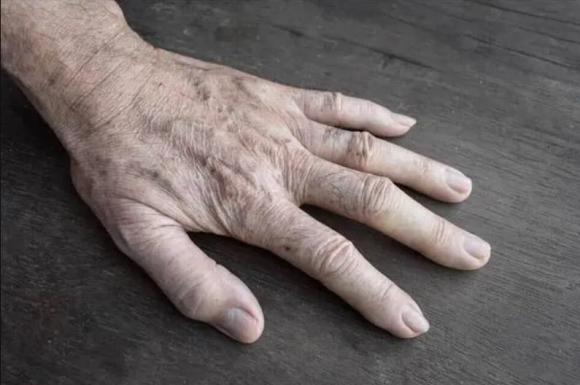 tuổi thọ, mu bàn tay liên quan đến tuổi thọ