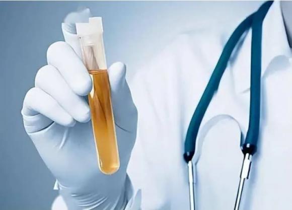 chăm sóc sức khỏe đúng cách, lưu ý khi chăm sóc sức khỏe, ung thư