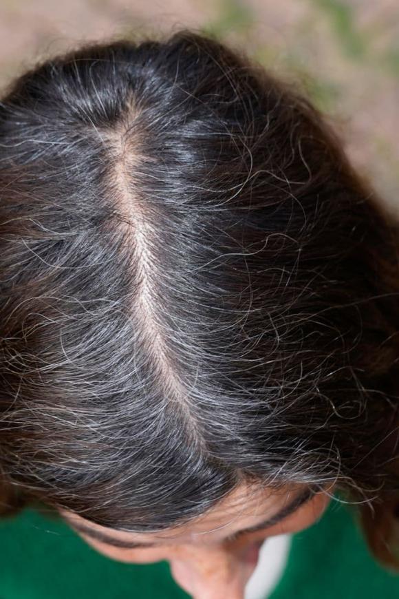 tóc bạc, tóc bạc đen trở lại, kiến thức 