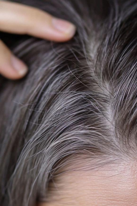 tóc bạc, tóc bạc đen trở lại, kiến thức 