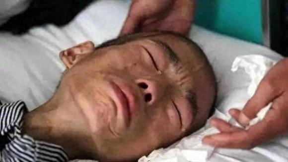 ung thư, thực phẩm gây ung thư