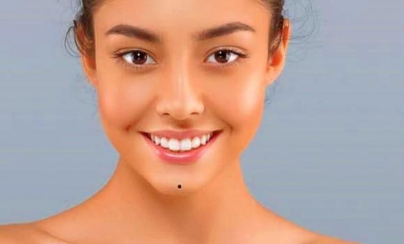 nốt ruồi trên cơ thể, nốt ruồi tài lộc, nốt ruồi son nốt ruồi trên mặt