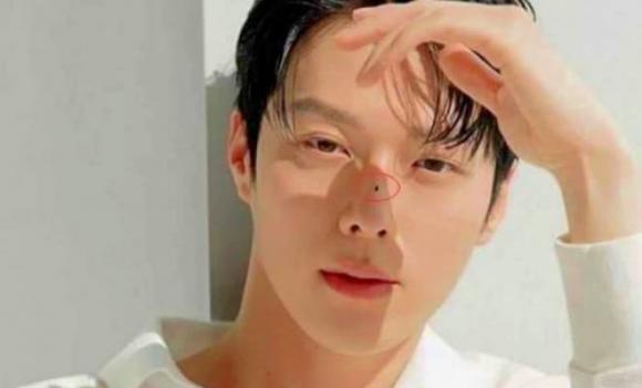 nốt ruồi trên cơ thể, nốt ruồi tài lộc, nốt ruồi son nốt ruồi trên mặt