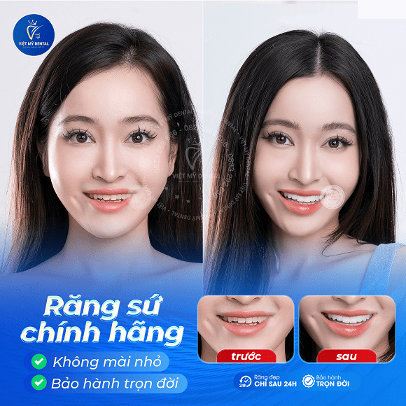nha khoa Việt Mỹ, nha khoa uy tín