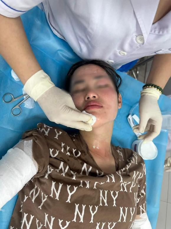 bóng bay, bóng bay phát nổ, giới trẻ