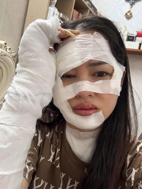 bóng bay, bóng bay phát nổ, giới trẻ
