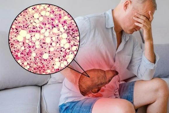 bệnh thường gặp sau tết, cúm, đột quỵ