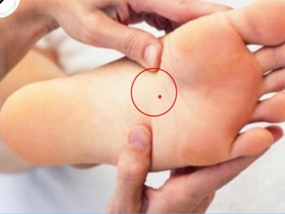 nốt ruồi ở lòng bàn chân, nốt ruồi phú quý, nốt ruồi phú quý