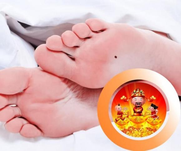 nốt ruồi ở lòng bàn chân, nốt ruồi phú quý, nốt ruồi phú quý