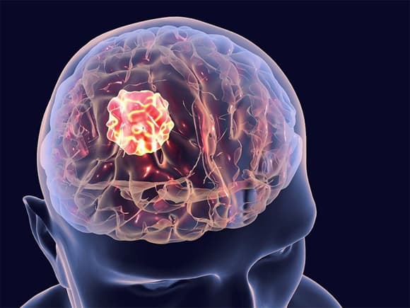 U não, diễn viên quý bình, sức khỏe
