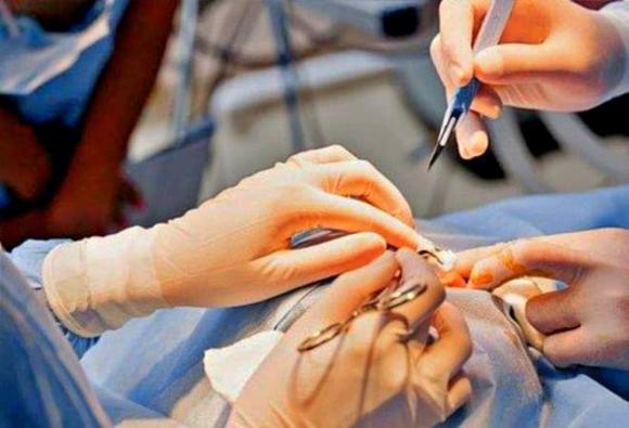 phẫu thuật thẩm mỹ, thay đổi khuôn mặt, căn cước, hộ chiếu, xuất nhập cảnh