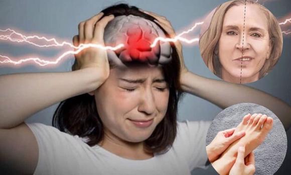 nhồi máu não, sức khỏe, chăm sóc sức khỏe, nguyên nhân gây nhồi máu não, thủ phạm gây nhồi máu não