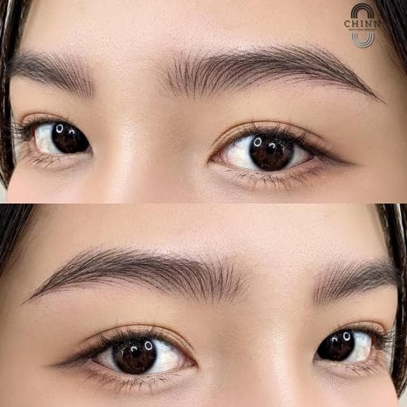 Thẩm mỹ Chinn Beauty, Chinn Beauty, TM Chinn Beauty