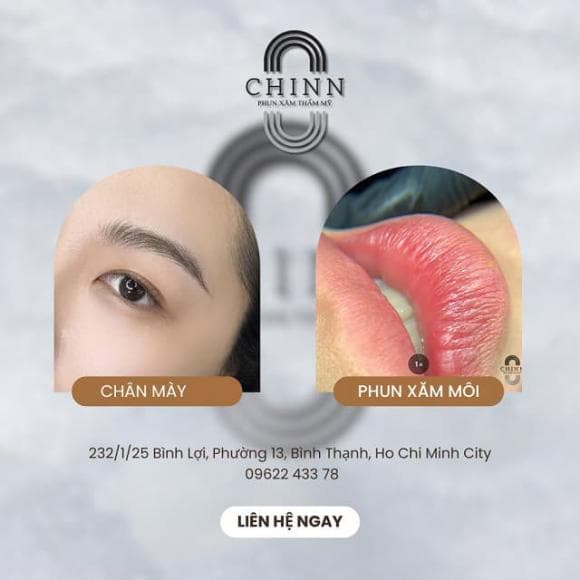 Thẩm mỹ Chinn Beauty, Chinn Beauty, TM Chinn Beauty