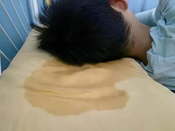 ung thư phổi, bệnh ung thư, bác sĩ