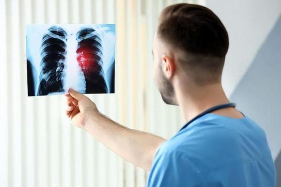 đờm, đờm ho ra từ phổi, đờm cổ họng, sức khỏe, khạc nhổ đờm, nuốt đờm