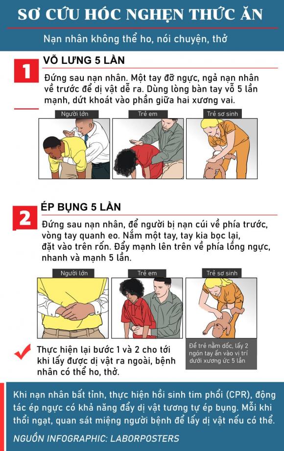 cấp cứu, hóc nghẹn, sơ cứu khi hóc nghẹn