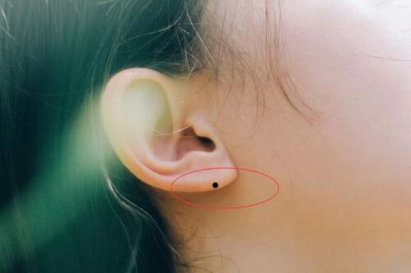 nốt ruồi, vị trí nốt ruồi, kiến thức