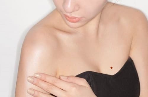 nốt ruồi, vị trí nốt ruồi, kiến thức