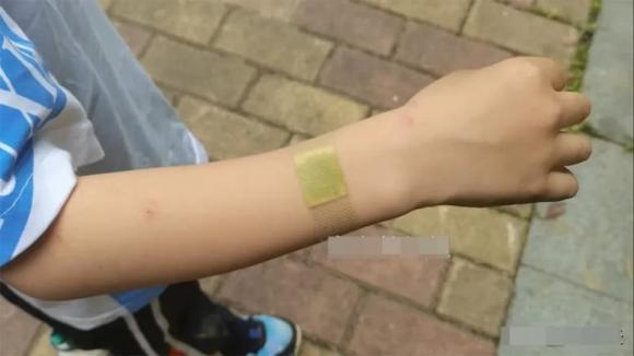 đuổi muỗi