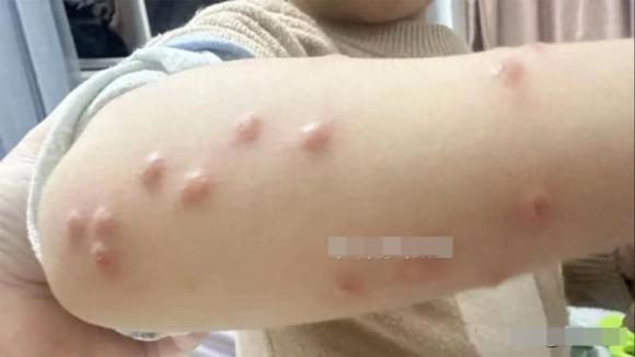 đuổi muỗi