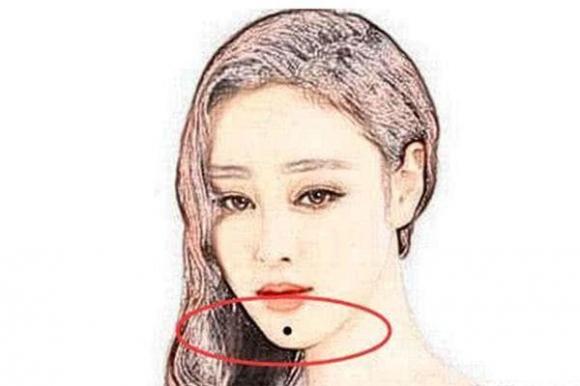 nốt ruồi, nốt ruồi giàu có