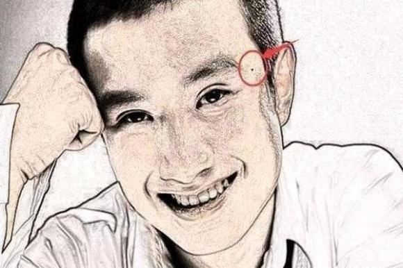 nốt ruồi, nốt ruồi giàu có