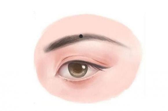 nốt ruồi, nốt ruồi giàu có