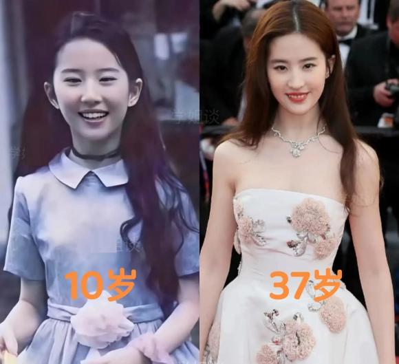  Lưu Diệc Phi, sao hoa ngữ, phẫu thuật thẩm mỹ