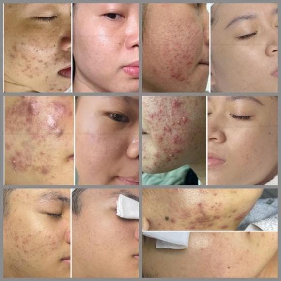 Hee's Beauty, làm đẹp, spa Hee's Beauty: