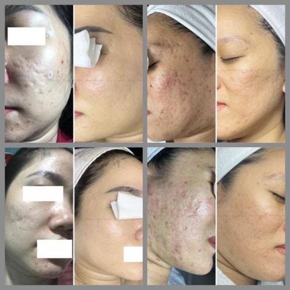 Hee's Beauty, làm đẹp, spa Hee's Beauty: