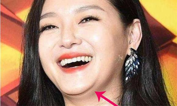 nốt xuồi xấu, nốt ruồi xui xẻo, tướng số