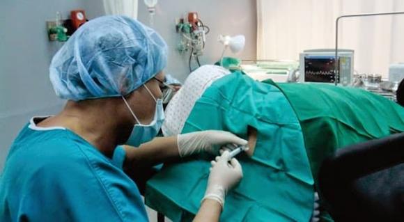 gây tê ngoài màng cứng, sinh con không đau