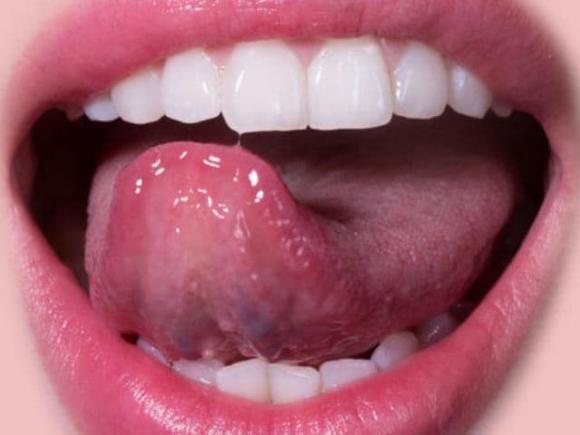 bài tập với lưỡi