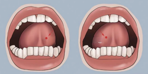 bài tập với lưỡi