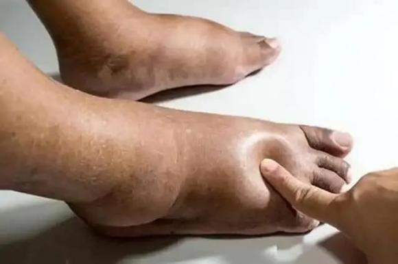 vải thiều, lợi ích của vải