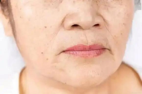 vải thiều, lợi ích của vải