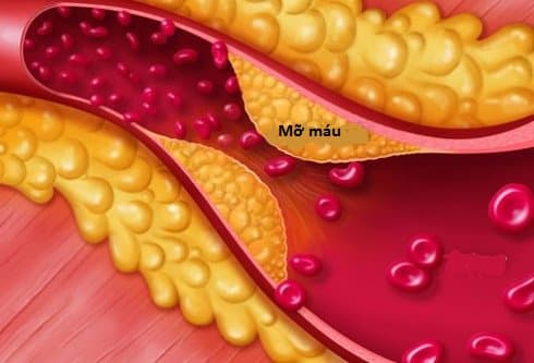 cá béo, cá trách, công dụng của việc ăn cá