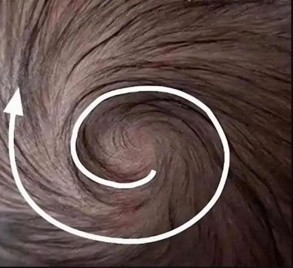 hai xoáy tóc trên đầu, trẻ hai xoáy tóc