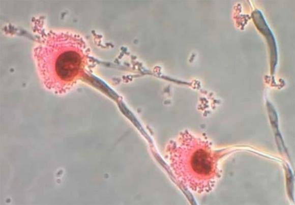 nấm độc, Aspergillus fumigatus, lây bệnh
