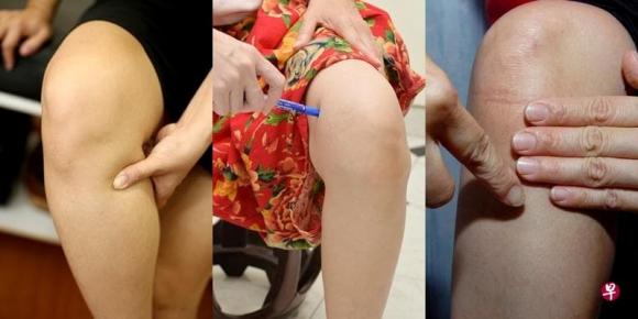 chăm sóc sức khỏe, lưu ý khi chăm sóc sức khỏe, đau đầu gối